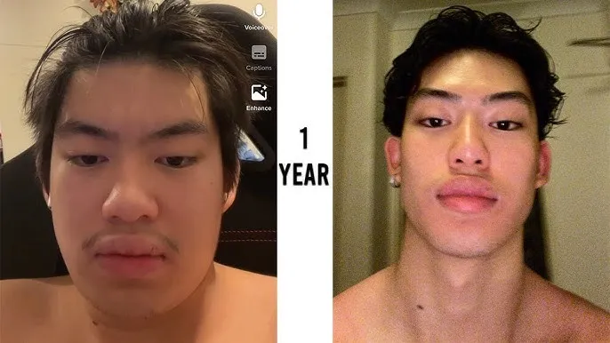 One year face transformation progress